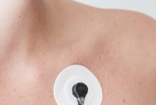 Rio Claro faz mutirão com mil atendimentos de cardiologia